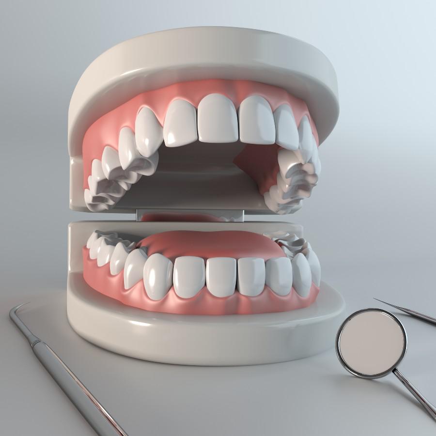 Full Mouth Reconstruction Chicago, IL